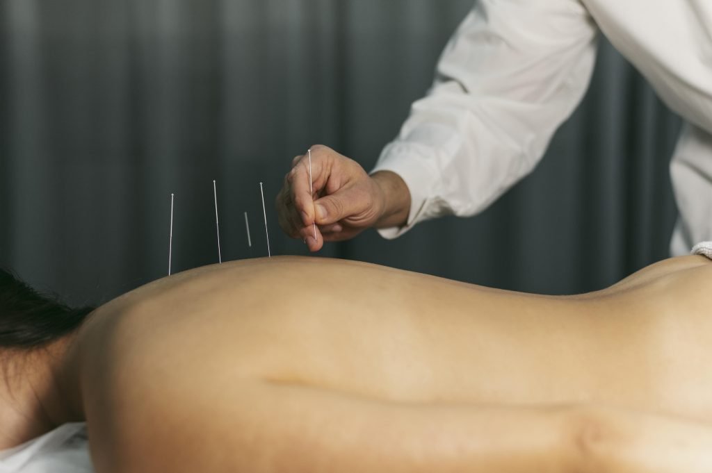 Acupuncturist in Vlissingen
